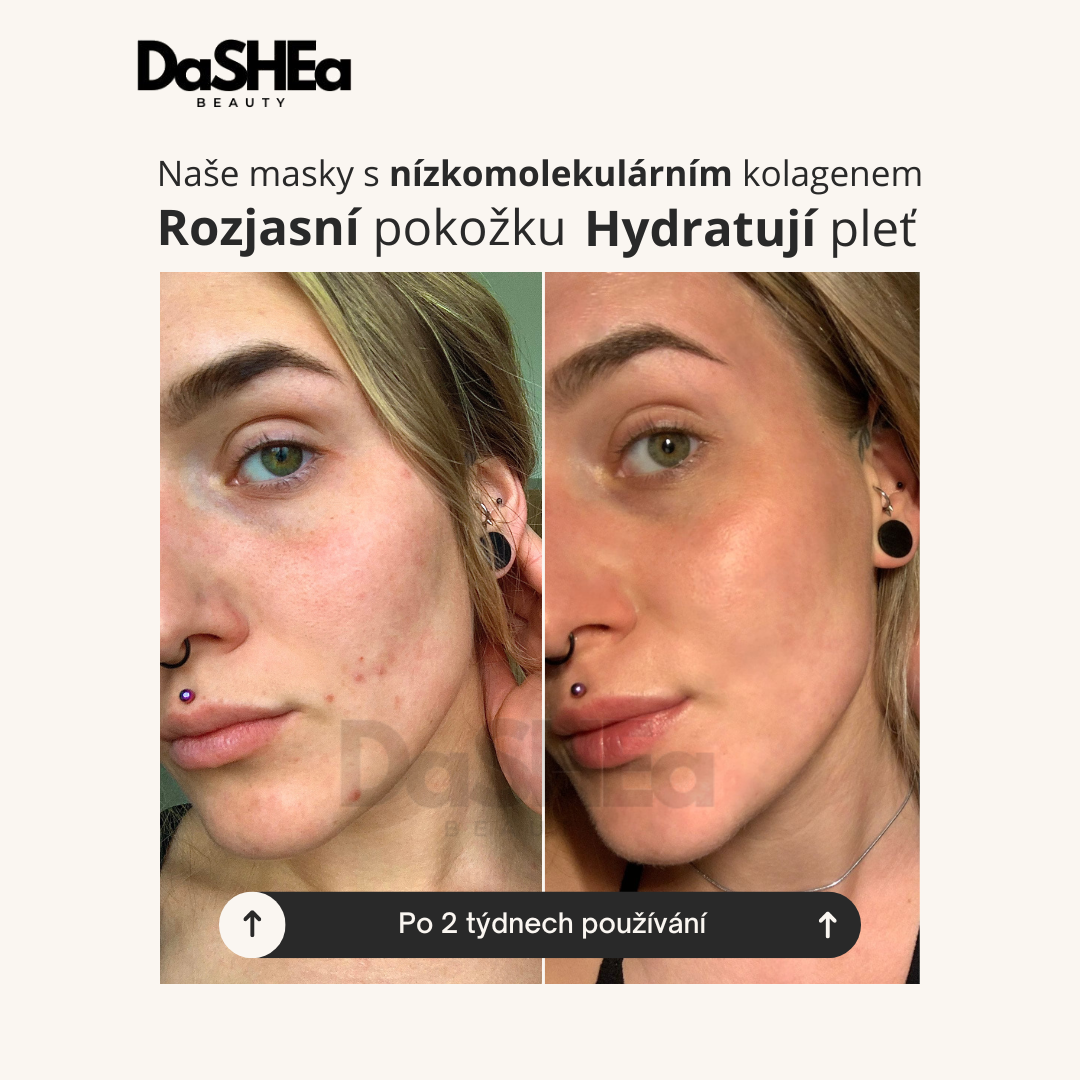 DaSHEa Bio-Kolagenové hloubkově hydratační masky